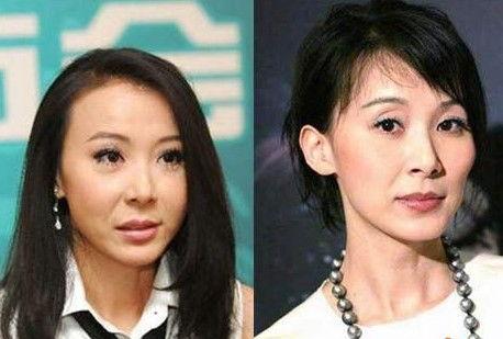 明星网红整容后遗症,美丽代价与反思