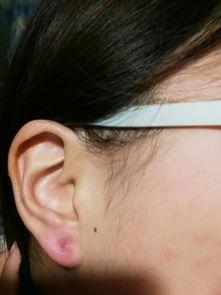 明星网红打的耳洞叫什么,明星同款耳饰引领时尚风潮